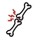 Joint Pain SVG Icon